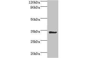 Western blot All lanes: Aminoacyl tRNA synthase complex-interacting multifunctional protein 1 antibody at 2 μg/mL + HepG2 whole cell lysate Secondary Goat polyclonal to rabbit IgG at 1/10000 dilution Predicted band size: 35, 38 kDa Observed band size: 35 kDa (AIMP1 antibody  (AA 25-180))