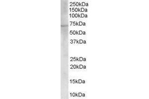 Western Blotting (WB) image for Choline O-Acetyltransferase (CHAT) peptide (ABIN369257) (Choline O-Acetyltransferase (CHAT) Peptide)