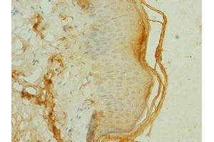 Immunohistochemistry of paraffin-embedded human skin tissue using ABIN7152849 at dilution of 1:100 (FRS3 antibody  (AA 101-400))