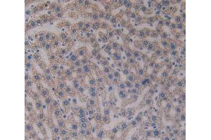 IHC-P analysis of liver tissue, with DAB staining. (Paxillin antibody  (AA 327-568))