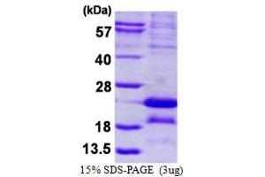 Image no. 1 for Melanoma Antigen Family A, 5 (MAGEA5) protein (His tag) (ABIN1098595)