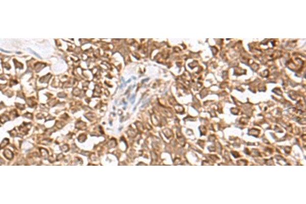 USP16 antibody