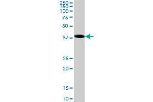 SYT1 monoclonal antibody (M01), clone 3A5. (SYT1 antibody  (AA 1-422))