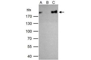 Immunoprecipitation (IP) image for anti-Zinc Finger E-Box Binding Homeobox 1 (ZEB1) antibody (ABIN2856075)