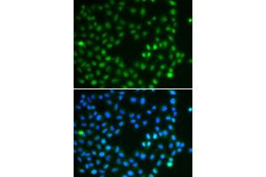 Immunofluorescence analysis of A549 cell using SALL4 antibody.