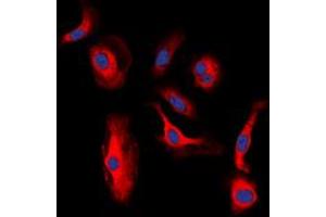 Immunofluorescent analysis of HER3 (pY1328) staining in MCF7 cells. (ERBB3 antibody  (C-Term, pTyr1328))