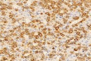 Immunohistochemistry analysis of paraffin-embedded rat pituitary gland using,GH1 (ABIN7074136) at dilution of 1: 2000 (Growth Hormone 1 antibody)