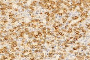 Immunohistochemistry analysis of paraffin-embedded rat pituitary gland using,GH1 (ABIN7074136) at dilution of 1: 2000 (Growth Hormone 1 antibody)