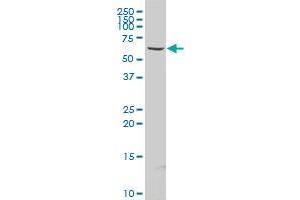 BBS1 polyclonal antibody (A01), Lot # 060614JCS1 Western Blot analysis of BBS1 expression in U-2 OS . (BBS1 antibody  (AA 187-295))