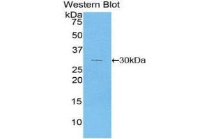Western Blotting (WB) image for anti-Phosphoinositide-3-Kinase, Class 2, alpha Polypeptide (PIK3C2A) (AA 172-403) antibody (ABIN1860217) (PIK3C2A antibody  (AA 172-403))