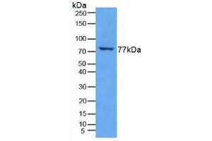 Figure. (TGM3 antibody  (AA 468-693))