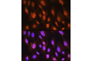 Immunofluorescence analysis of C6 cells using DDIT3/CHOP Rabbit pAb (ABIN6131563, ABIN6139461, ABIN6139464 and ABIN6222163) at dilution of 1:100. (DDIT3 antibody)
