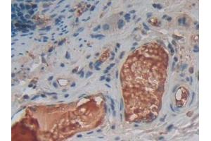 Detection of TNFSF14 in Human Rectum Tissue using Polyclonal Antibody to Tumor Necrosis Factor Ligand Superfamily, Member 14 (TNFSF14) (TNFSF14 antibody  (AA 62-240))