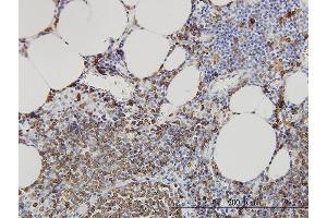 Immunoperoxidase of monoclonal antibody to SMPD2 on formalin-fixed paraffin-embedded human lymph node. (SMPD2 antibody  (AA 1-423))