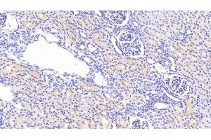Detection of ACTN1 in Human Kidney Tissue using Polyclonal Antibody to Actinin Alpha 1 (ACTN1) (ACTN1 antibody  (AA 28-260))