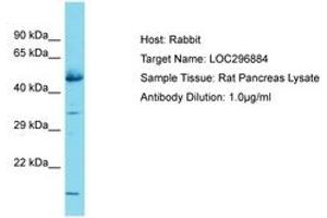 Image no. 1 for anti-Glucocorticoid Induced Transcript 1 (GLCCI1) (AA 255-304) antibody (ABIN6750335) (GLCCI1 antibody  (AA 255-304))