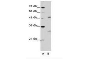 Image no. 2 for anti-Eukaryotic Translation Initiation Factor 4H (EIF4H) (AA 149-198) antibody (ABIN203036) (EIF4H antibody  (AA 149-198))