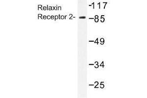 Image no. 1 for anti-Relaxin/insulin-Like Family Peptide Receptor 2 (RXFP2) antibody (ABIN317772) (RXFP2 antibody)