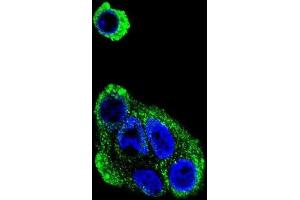 Immunofluorescence (IF) image for anti-Alcohol Dehydrogenase 1B (Class I), beta Polypeptide (ADH1B) antibody (ABIN3002782) (ADH1B antibody)