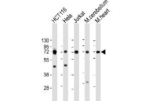 All lanes : Anti-TCF7L2 Antibody (N-term) at 1:2000 dilution Lane 1: HC whole cell lysate Lane 2: Hela whole cell lysate Lane 3: Jurkat whole cell lysate Lane 4: mouse cerebellum lysate Lane 5: mouse heart lysate Lysates/proteins at 20 μg per lane. (TCF7L2 antibody  (N-Term))