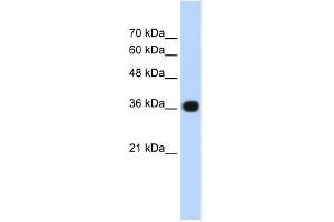 WB Suggested Anti-TNRC5 Antibody Titration:  0. (TNRC5 antibody  (C-Term))