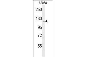 Western blot analysis in A2058 cell line lysates (35ug/lane). (NCKAP1 antibody  (AA 631-659))