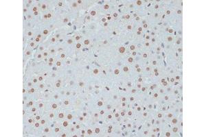 Immunohistochemistry (Paraffin-embedded Sections) (IHC (p)) image for anti-Tumor Protein P53 (TP53) (pSer33) antibody (ABIN7265276)