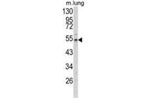 Western blot analysis of Fibulin-3 (arrow) in mouse lung tissue lysates (35ug/lane) using Fibulin-3  Antibody  (N-term). (FBLN3 antibody  (N-Term))