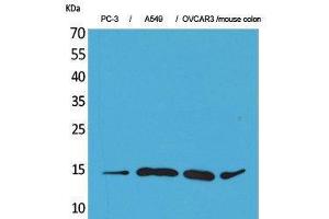 Western Blotting (WB) image for anti-Chemokine (C-C Motif) Ligand 26 (CCL26) (Internal Region) antibody (ABIN3187694)