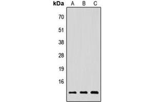 Western blot analysis of NRG4 expression in HEK293T (A), Raw264.