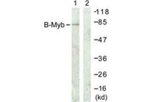 Western blot analysis of extracts from A549 cells, using B-Myb (Ab-577/581) Antibody. (MYBL2 antibody  (AA 551-600))