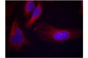 Image no. 1 for anti-Cas-Br-M (Murine) Ecotropic Retroviral Transforming Sequence (CBL) (pTyr700) antibody (ABIN319294) (CBL antibody  (pTyr700))