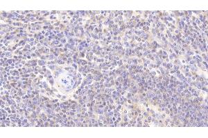 Immunohistochemistry (IHC) image for anti-Parkinson Protein 7 (PARK7) (AA 1-189) antibody (ABIN7436813)