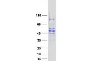 Validation with Western Blot (GCDH Protein (Transcript Variant 1) (Myc-DYKDDDDK Tag))