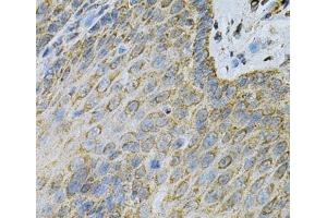 Immunohistochemistry of paraffin-embedded Human esophagus using AK1 Polyclonal Antibody at dilution of 1:100 (40x lens).