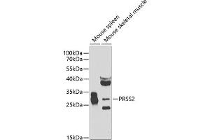 Western blot analysis of extracts of various cell lines, using PRSS2 antibody (ABIN6131363, ABIN6146279, ABIN6146280 and ABIN6223919) at 1:1000 dilution.