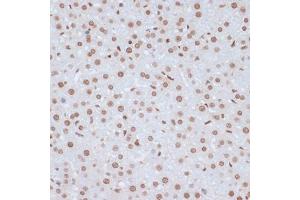 Immunohistochemistry of paraffin-embedded rat liver using Phospho-ERK1-Y204 antibody (ABIN3019889, ABIN3019890, ABIN3019891 and ABIN1681795) at dilution of 1:100 (40x lens). (ERK1 antibody  (pTyr204))
