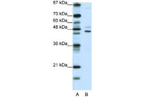WB Suggested Anti-JMJD4 Antibody Titration:  0. (JMJD4 antibody  (C-Term))
