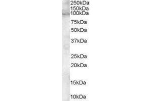 Western Blotting (WB) image for ADAM Metallopeptidase Domain 12 (ADAM12) peptide (ABIN370279) (ADAM Metallopeptidase Domain 12 (ADAM12) Peptide)