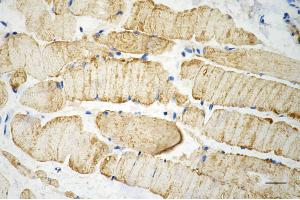Immunohistochemistry was performed on paraffin-embedded mouse skeletal muscle using desmin antibody (ABIN7798314), 1:200). (Recombinant Desmin antibody)
