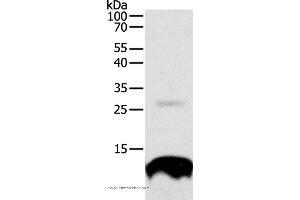 Western blot analysis of 293T cell, using TNFRSF12A Polyclonal Antibody at dilution of 1:300 (TNFRSF12A antibody)