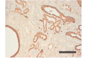 Image no. 1 for anti-Keratin Acidic (AE1) antibody (ABIN341106) (Keratin Acidic (AE1) antibody)