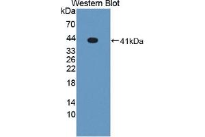 Detection of recombinant LXRa using Polyclonal Antibody to Liver X Receptor Alpha (LXRa) (NR1H3 antibody  (AA 95-434))
