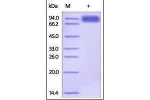 SDS-PAGE (SDS) image for TYRO3 Protein Tyrosine Kinase (TYRO3) (AA 41-428) protein (Fc Tag) (ABIN2181883)