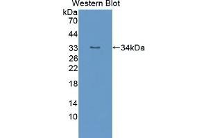 Detection of Recombinant TTK, Mouse using Polyclonal Antibody to TTK Protein Kinase (TTK) (Mps1 antibody  (AA 527-786))