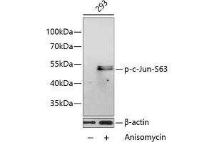 Western blot analysis of extracts of 293 cells, using Phospho-c-Jun-S63 antibody (ABIN3023570, ABIN3023571, ABIN3023572 and ABIN6225413) at 1:1000 dilution. (C-JUN antibody  (pSer63))