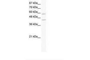 Image no. 1 for anti-DCP1 Decapping Enzyme Homolog A (S. Cerevisiae) (DCP1A) (AA 199-248) antibody (ABIN202699) (DCP1A antibody  (AA 199-248))