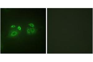 Immunofluorescence analysis of A549 cells, using Arrestin 1 (Ab-412) Antibody.
