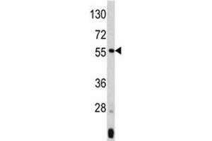 Western blot analysis of ANGPTL3 antibody and mouse liver tissue lysate. (ANGPTL3 antibody  (AA 82-114))