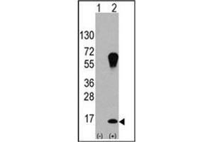 Western blot analysis of LC3 (APG8a) (arrow) using LC3 Antibody . (MAP1LC3A antibody)